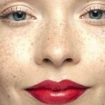 Пигментные пятна – не приговор: избавьтесь от изъяна без проблем