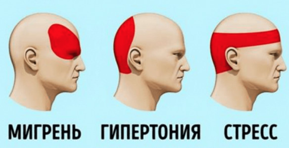 Болит голова и нет таблетки? Не беда! Есть выход с положения